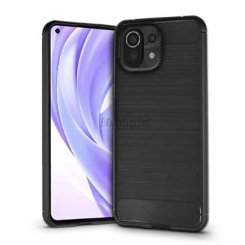 Xiaomi Mi 11 Lite LTE/11 Lite 5G szilikon hátlap - Carbon - fekete kép